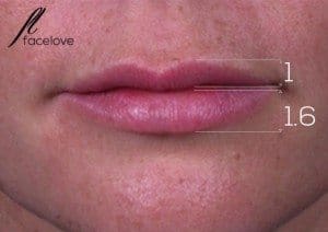 the golden ratio lip fillers melbourne