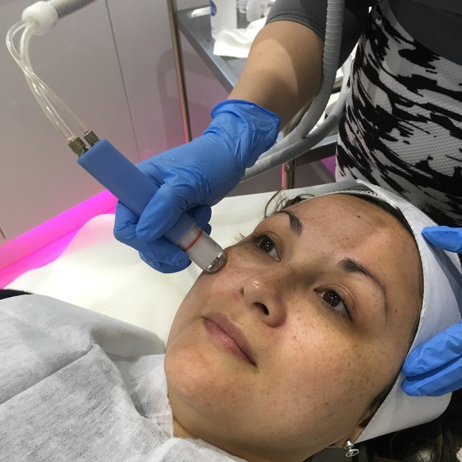 Microhydrabrasion treatment facelove