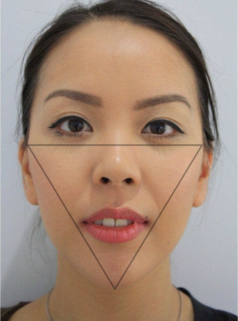 Facial reshaping triangle