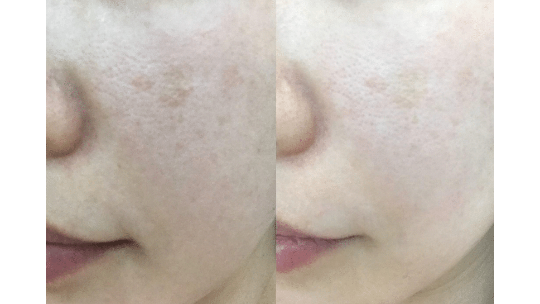 exosomes exomide xytide stem cells pigment